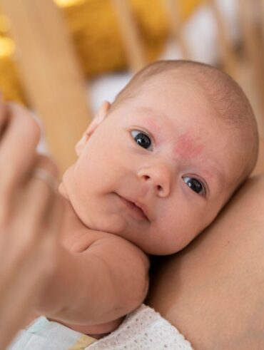 atopický ekzém načastejšie kožné ochorenia detí kožné ochorenia detí alergény Bioderma krém na atopický ekzém čo na atopický ekzém atopický ekzém u detí príznaky atopický ekzém atopický ekzém remisia atopický ekzém relaps