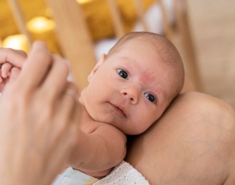 atopický ekzém načastejšie kožné ochorenia detí kožné ochorenia detí alergény Bioderma krém na atopický ekzém čo na atopický ekzém atopický ekzém u detí príznaky atopický ekzém atopický ekzém remisia atopický ekzém relaps